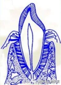 牙周刮治技术,从检查到操作方法,全套要点总结!