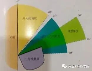 牙周刮治技术,从检查到操作方法,全套要点总结!