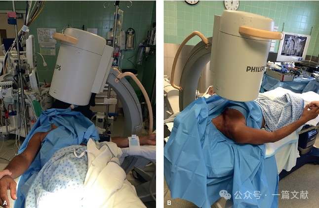 肱骨近端骨折术中透视技巧