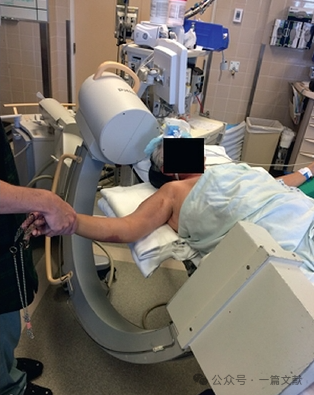 肱骨近端骨折术中透视技巧