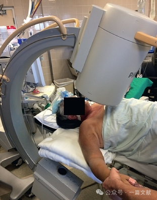 肱骨近端骨折术中透视技巧