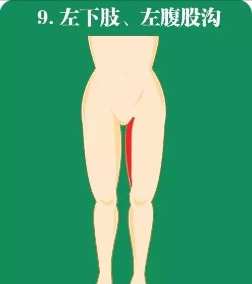 急性心肌梗死如何快速高效急救?