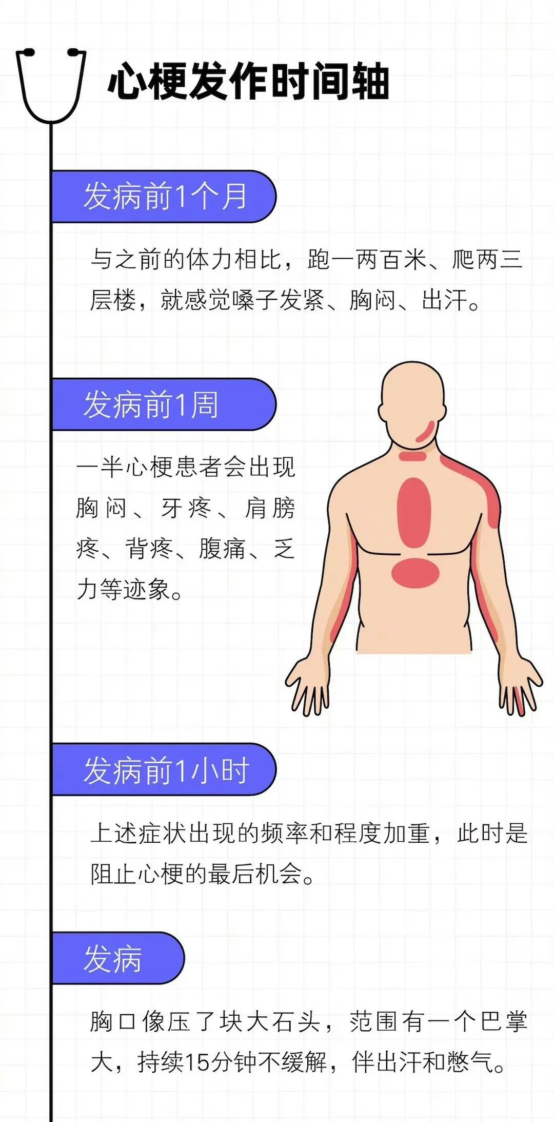 急性心肌梗死如何快速高效急救?