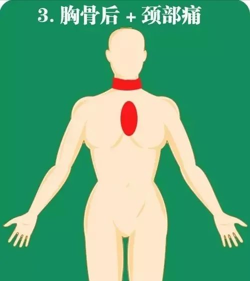 急性心肌梗死如何快速高效急救?