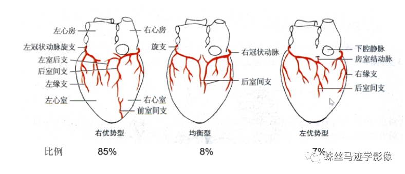 冠状动脉详细解剖,收藏级!