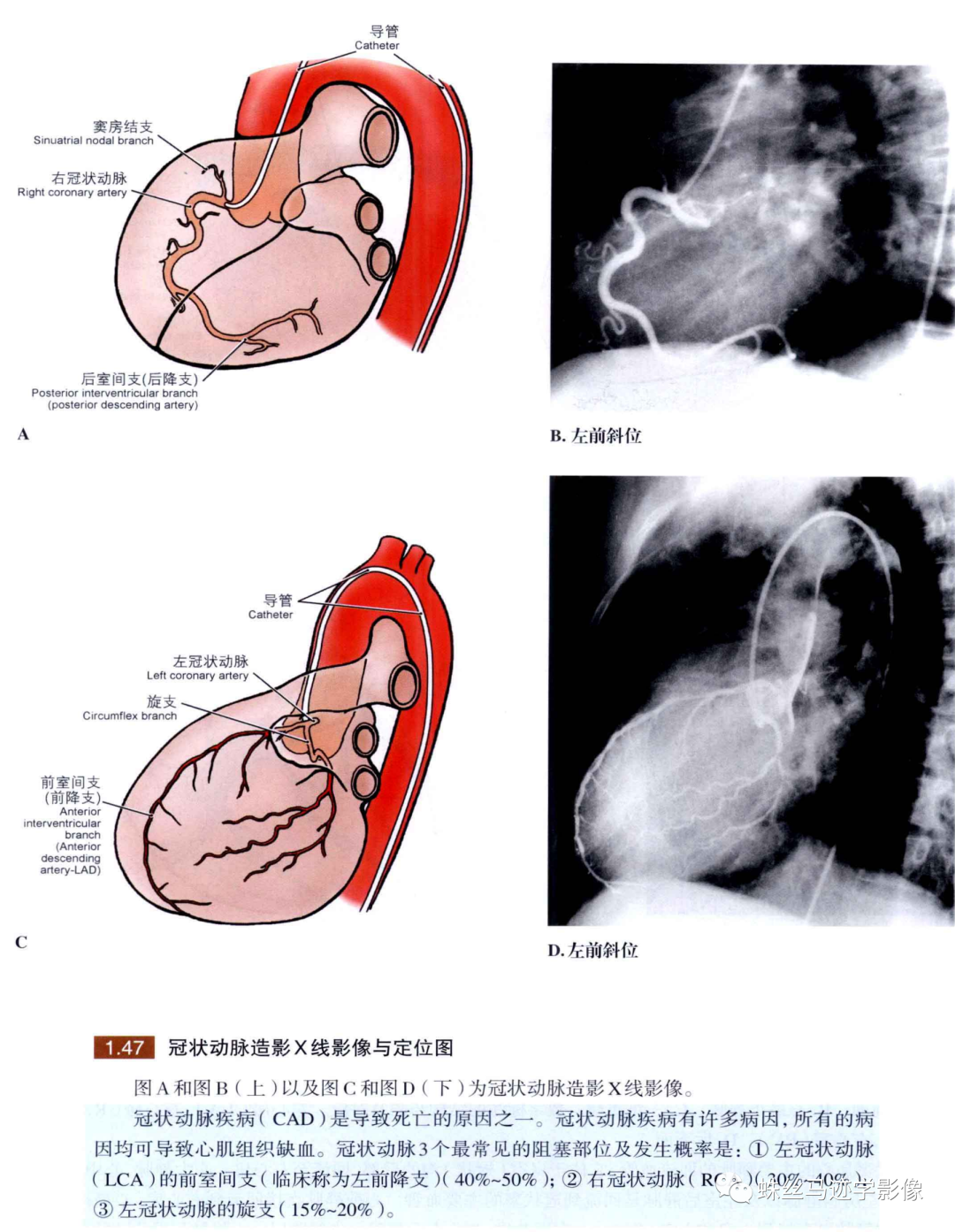 冠状动脉详细解剖,收藏级!