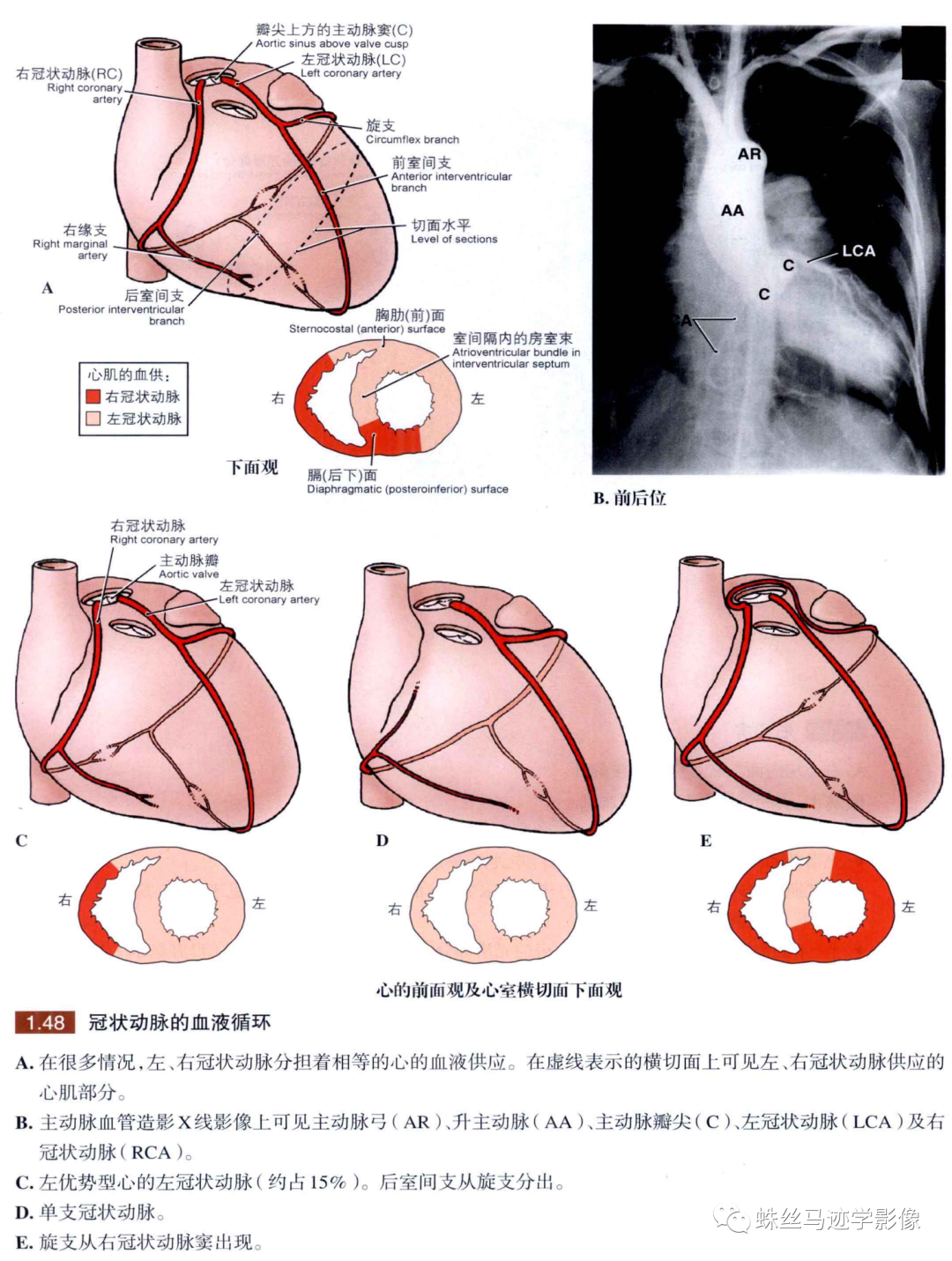 冠状动脉详细解剖,收藏级!