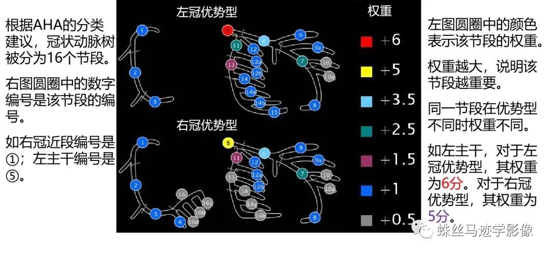 冠状动脉详细解剖,收藏级!