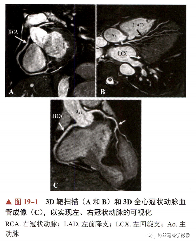 冠状动脉详细解剖,收藏级!