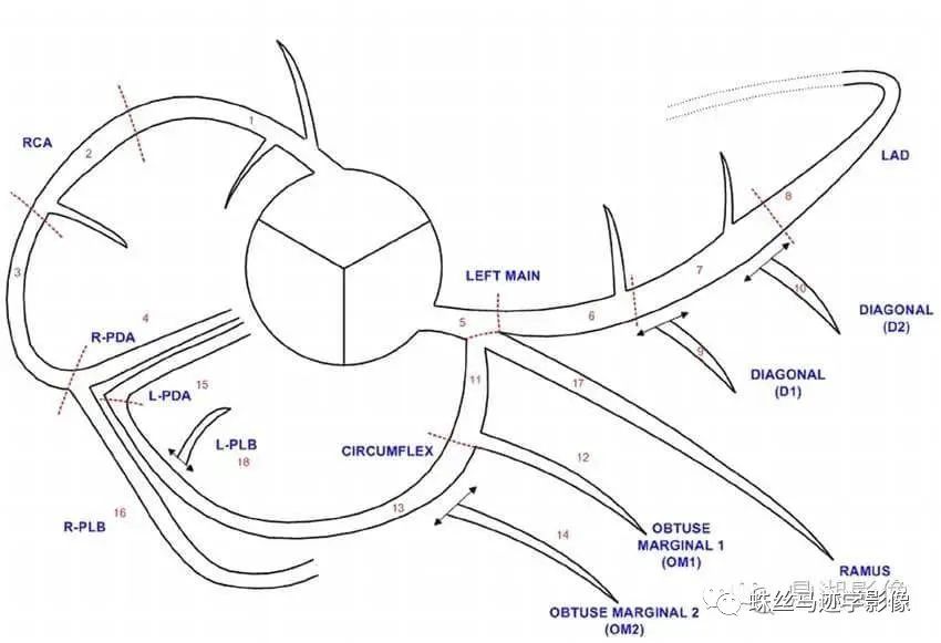 冠状动脉详细解剖,收藏级!