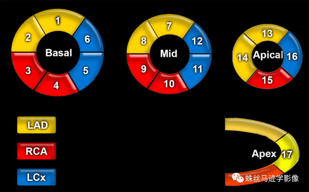 冠状动脉详细解剖,收藏级!