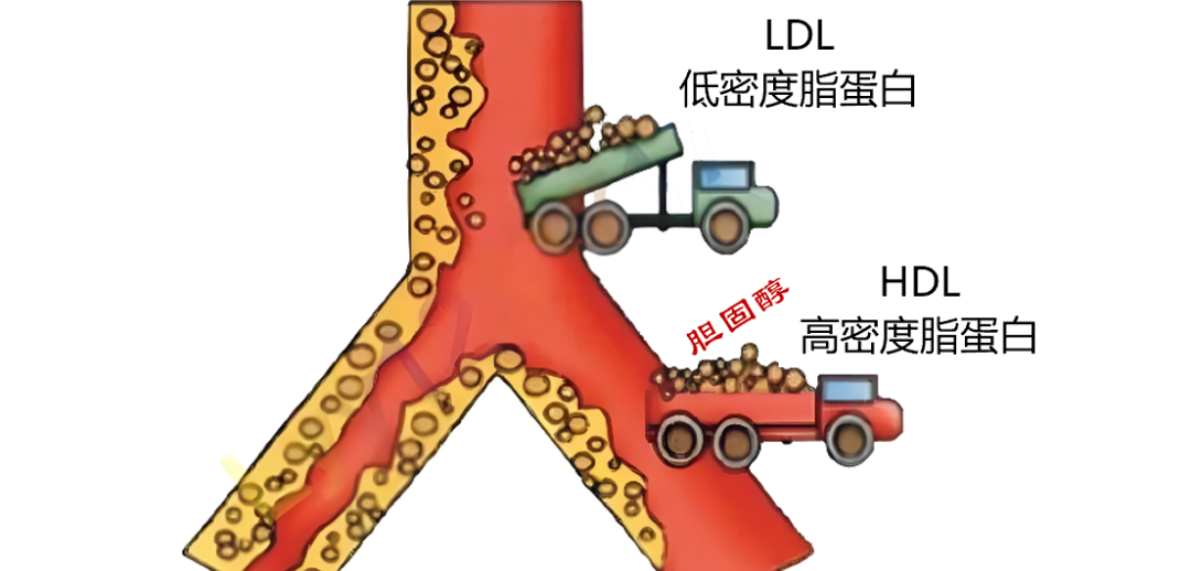 他汀到底该吃多久？这篇文章说明白了！