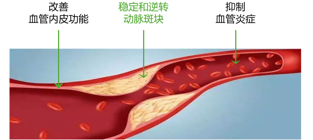 他汀到底该吃多久？这篇文章说明白了！