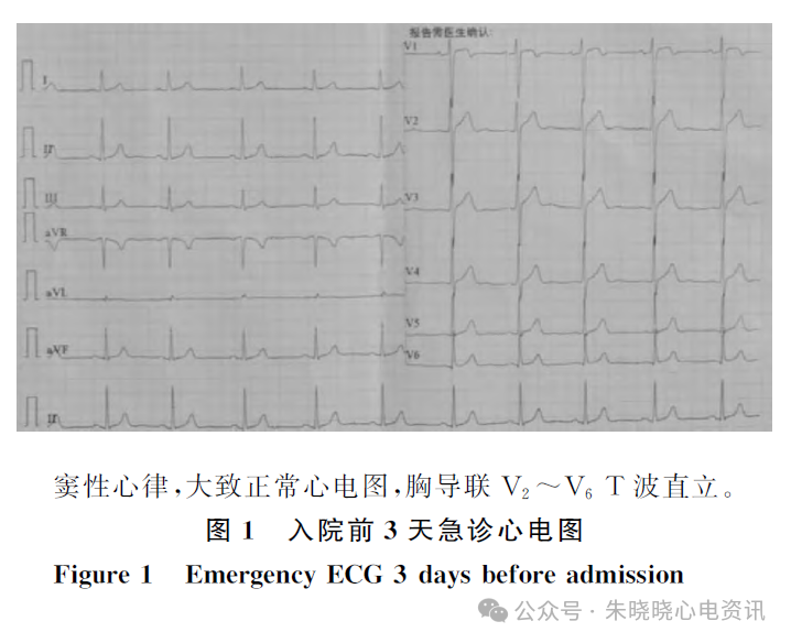 年轻患者Wellens综合征的T波动态演变