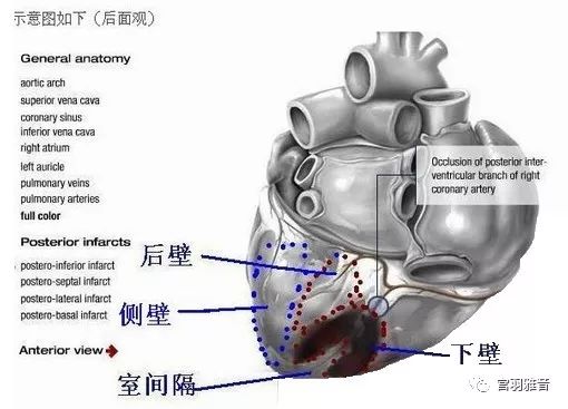 12导、15导、18导连接示意图及心脏各壁超声解剖位置与心电图导联对应关系
