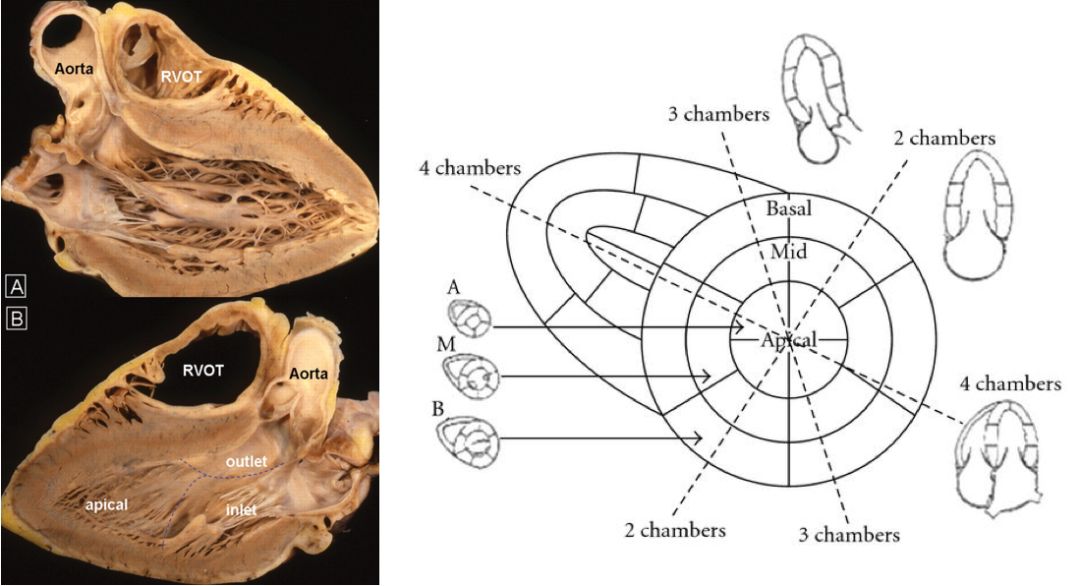12导、15导、18导连接示意图及心脏各壁超声解剖位置与心电图导联对应关系