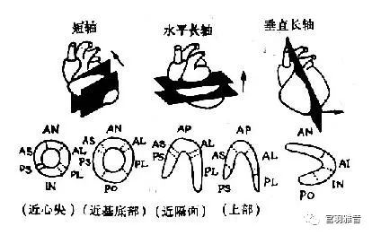 12导、15导、18导连接示意图及心脏各壁超声解剖位置与心电图导联对应关系