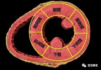 12导、15导、18导连接示意图及心脏各壁超声解剖位置与心电图导联对应关系