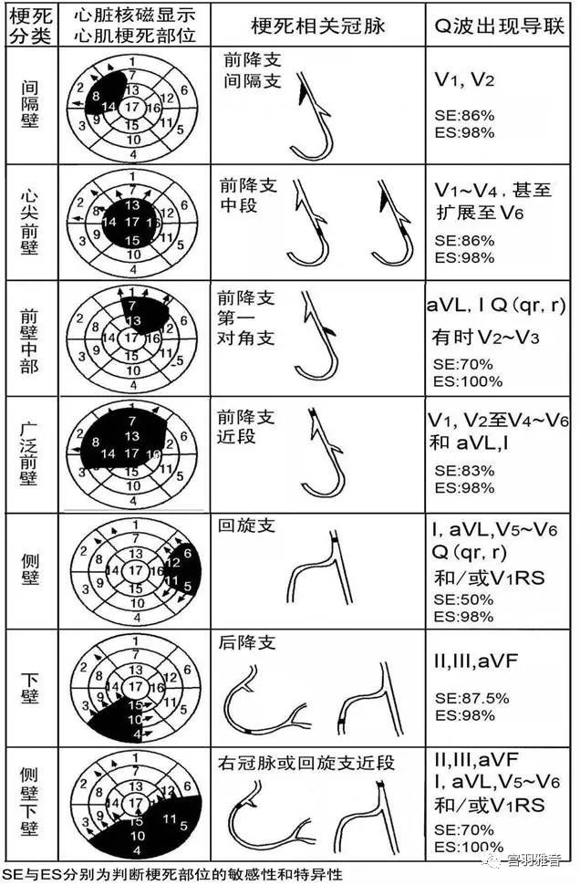12导、15导、18导连接示意图及心脏各壁超声解剖位置与心电图导联对应关系