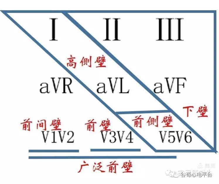 12导、15导、18导连接示意图及心脏各壁超声解剖位置与心电图导联对应关系