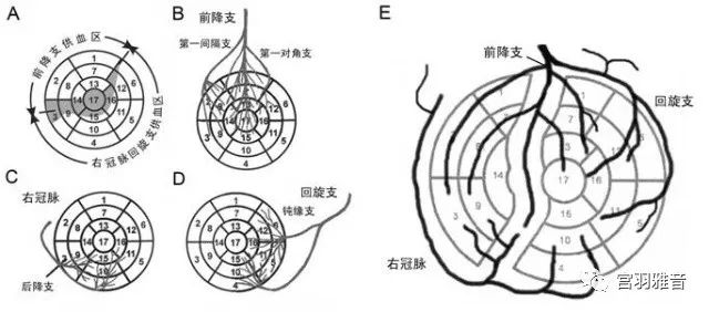 12导、15导、18导连接示意图及心脏各壁超声解剖位置与心电图导联对应关系