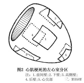 12导、15导、18导连接示意图及心脏各壁超声解剖位置与心电图导联对应关系