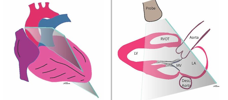 12导、15导、18导连接示意图及心脏各壁超声解剖位置与心电图导联对应关系