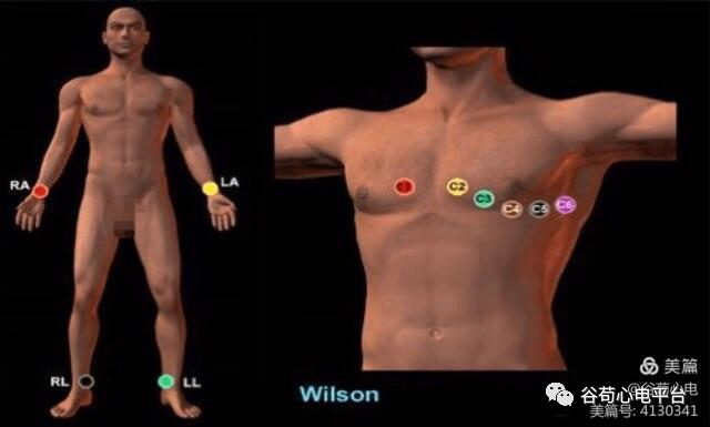 12导、15导、18导连接示意图及心脏各壁超声解剖位置与心电图导联对应关系