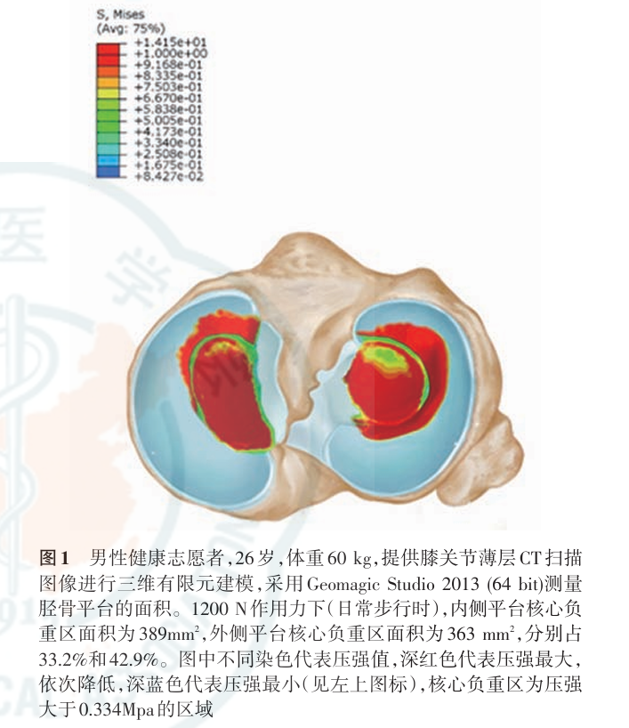 【一文综述】了解胫骨平台骨折的复位标准