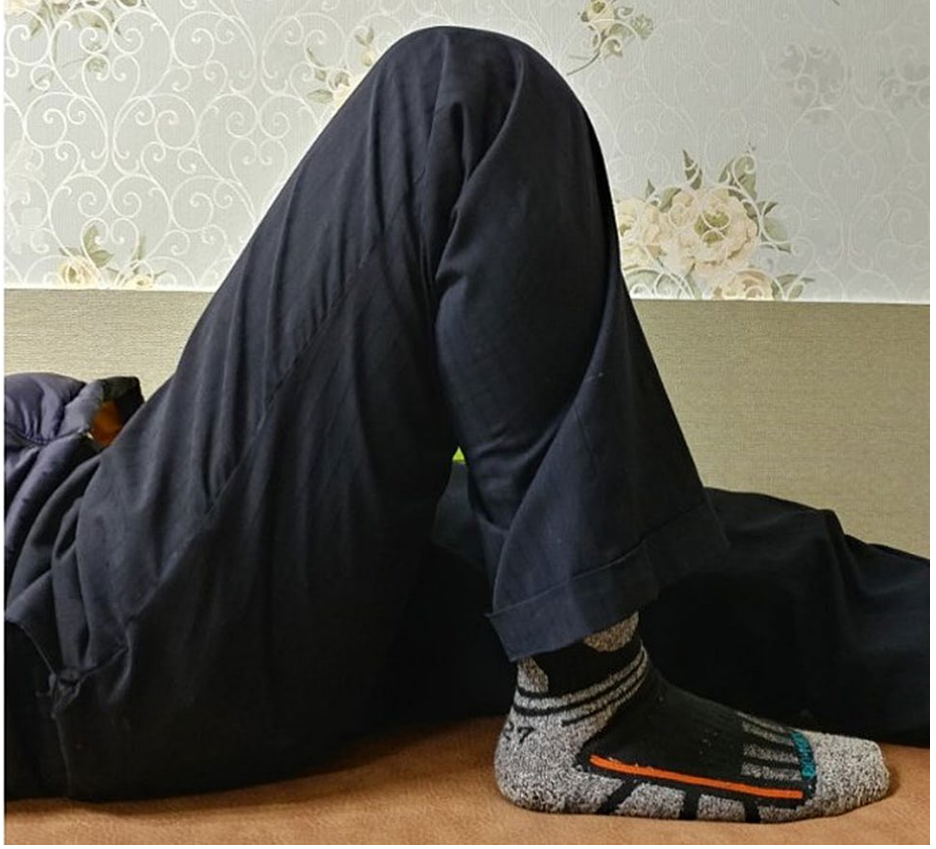 髌骨下极粉碎性骨折的缝线桥锚钉固定技术