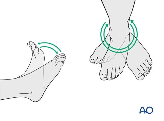 胫骨简单横形骨折的MIPO加压钢板内固定AO指南