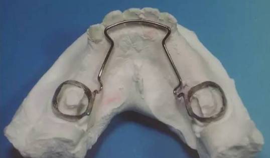 各种间隙保持器赏析