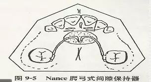 各种间隙保持器赏析