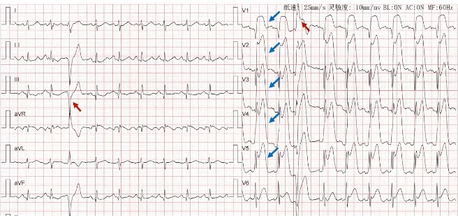 1654767288320722.png 9