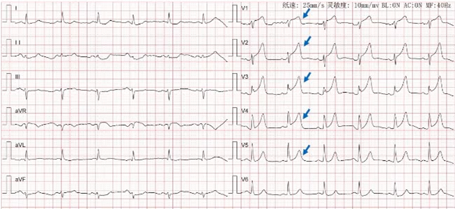 1654767258636745.png 9