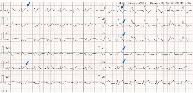 1654767239511687.png 9