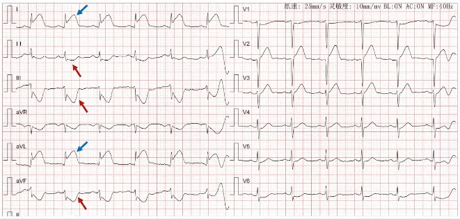 1654767298136693.png 9