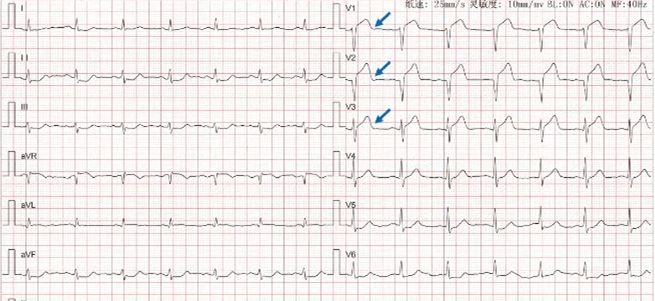 1654767270112089.png 9