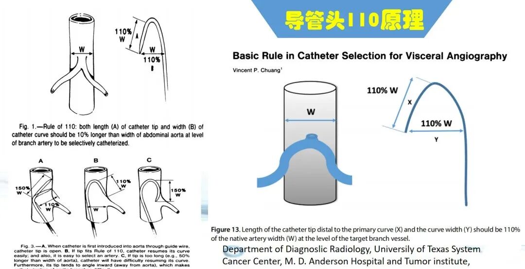 介入技术：导丝的基本操作