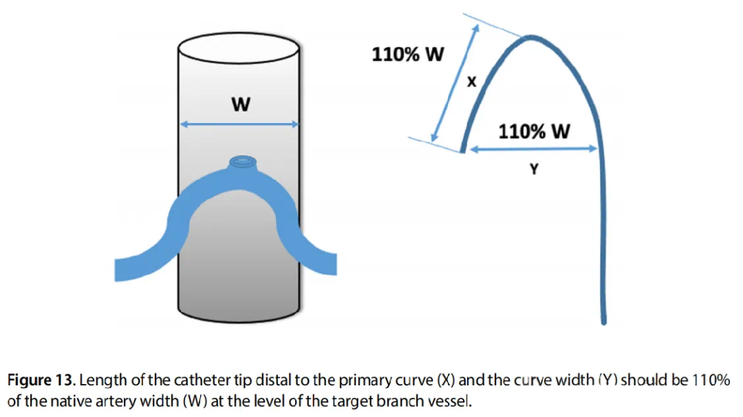 介入技术：导丝的基本操作
