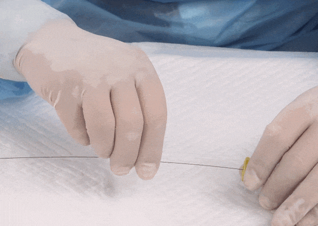 介入技术：导丝的基本操作