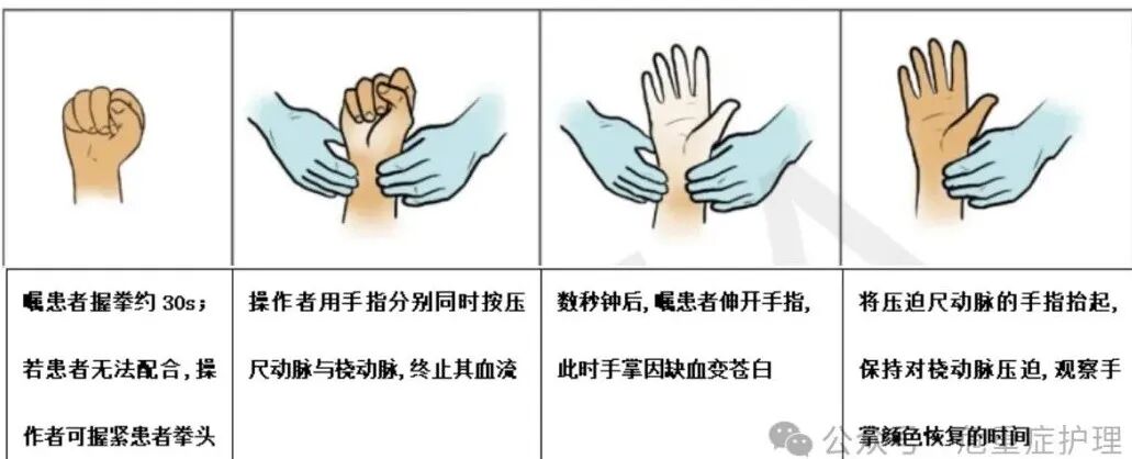 经桡动脉及远端桡动脉穿刺技术,干货满满!