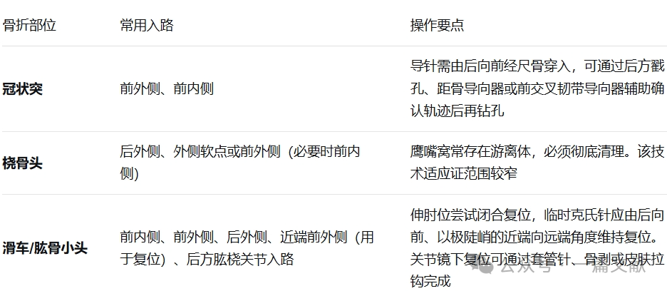 JAAOS:5种肘关节骨折内固定手术入路,100%干货!