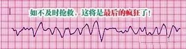 教你心电图，没有理由看不懂！