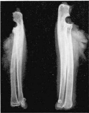 经关节截指——是否保留软骨?