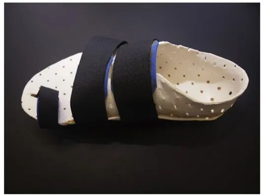 【手术技巧】拇外翻非截骨韧带联合术(Syndesmosis