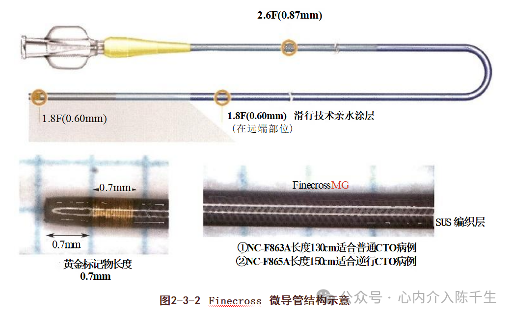 冠状动脉慢性完全闭塞病变介入治疗学习笔记：微导管的选择和操作技术