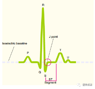 教你用最简单方法学习心电图！