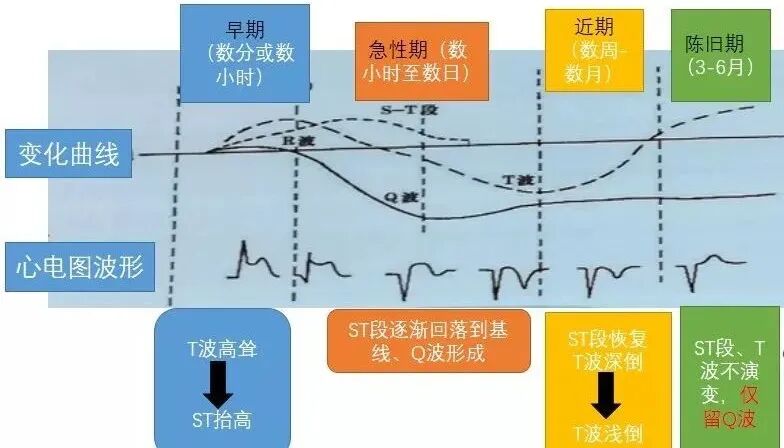 教你用最简单方法学习心电图！