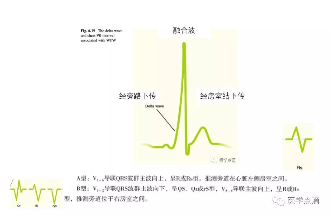 教你用最简单方法学习心电图！